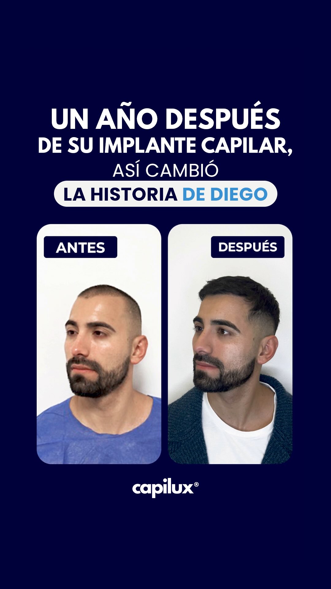 AÑOS BUSCANDO LA SOLUCIÓN DEFINITIVA PARA AL ALOPECIA, HASTA QUE LOGRÓ EL RESULTADO QUE NECESITABA